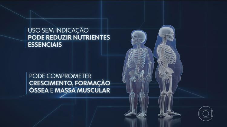 Uso indiscriminado de canetas emagrecedoras por jovens preocupa médicos no Brasil