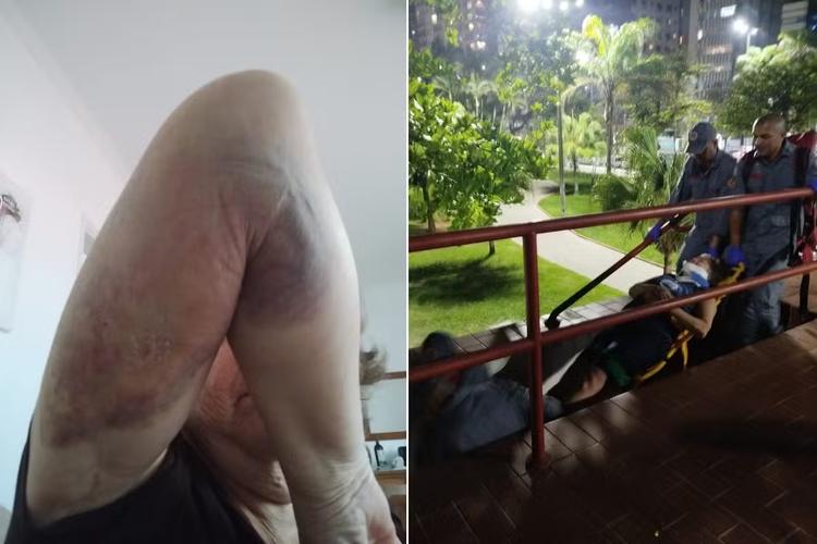 Guarda-corpo cede e mulher cai de escadaria durante exercício na orla de Santos