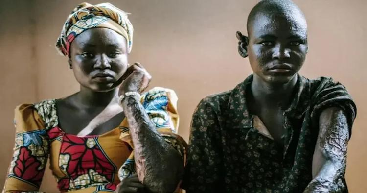 Hermanos sobrevivientes de Boko Haram deciden perdonar a quienes asesinaron a su familia