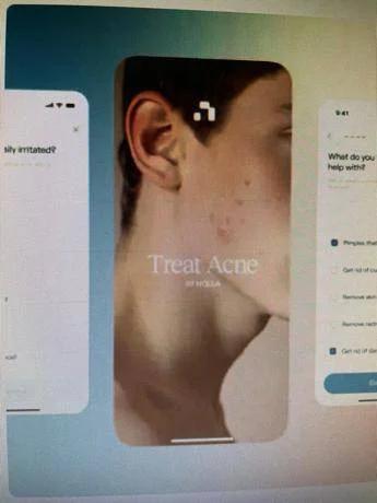 Ai prescrive farmaci contro l'acne, esperti Siiam: "Progresso in Medicina non si misura dal numero di decisioni automatizzate, ma dai benefici concreti per i pazienti"