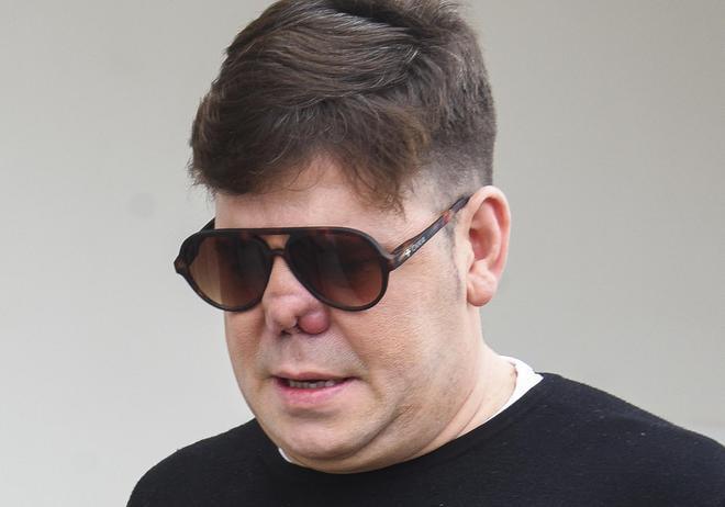 Lucas, de 'Andy y Lucas', se pronuncia tras su complicada operación: "Ya tengo nariz"
