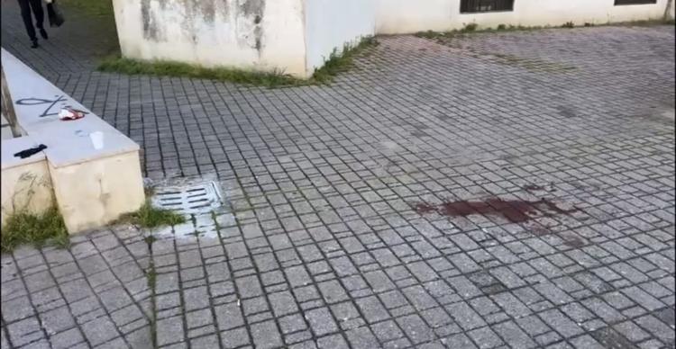 Foggia, massacrato di botte in pieno centro: 24 enne in gravi condizioni