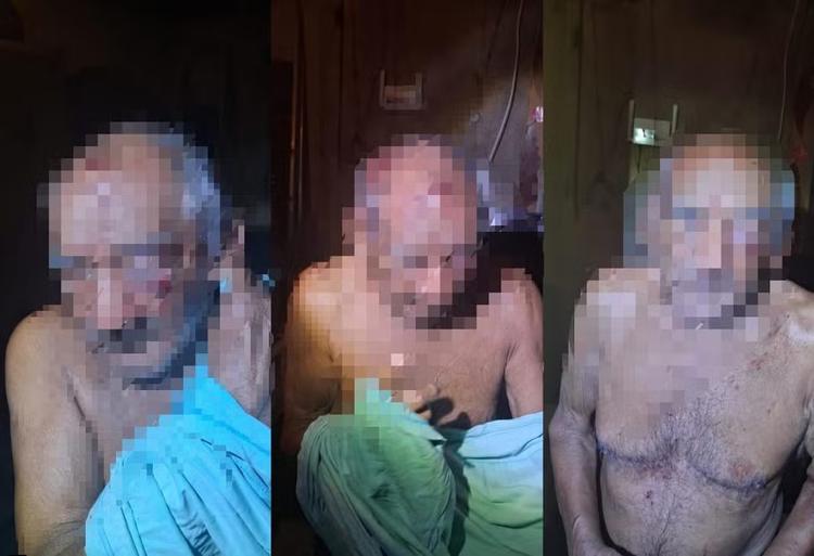 Novo caso de violência contra idoso é registrado em Óbidos, no Pará; homem de 88 anos é agredido com pedras e pedaço de madeira