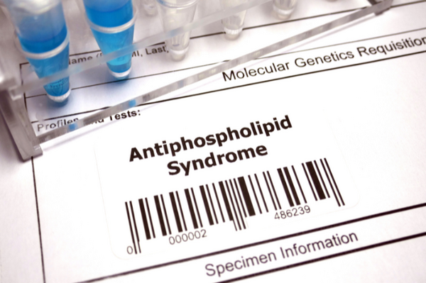 Sindrome antifosfolipidi: diagnosi, biomarcatori e nuove terapie per l’APS