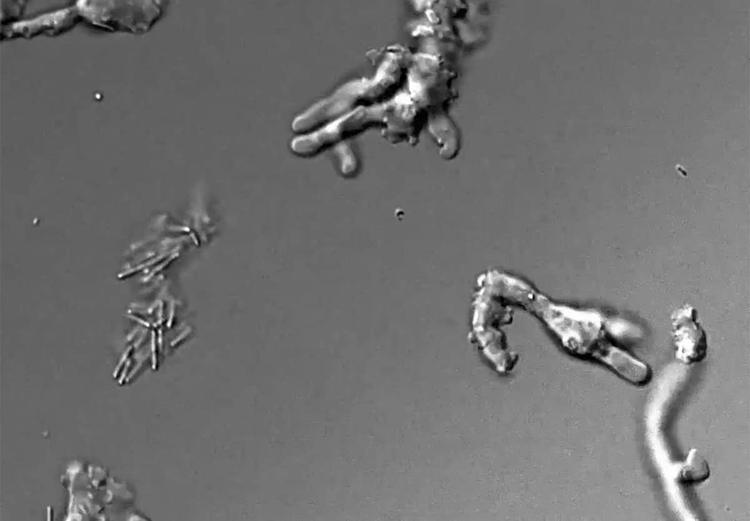 Neuer Hitzerekord: Komplexe irdische Zellen gedeihen bei 63°