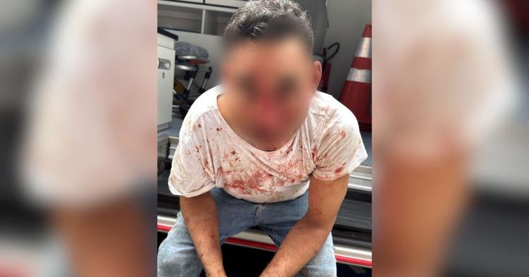 Homem bêbado é espancado na frente de bar 24h em Balneário Camboriú