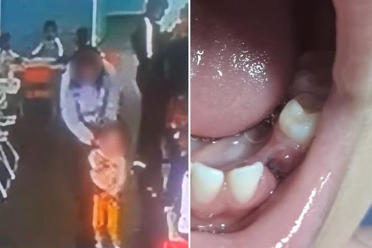 Família denuncia professora após criança de 3 anos perder dente em escola no litoral de SP; VÍDEO