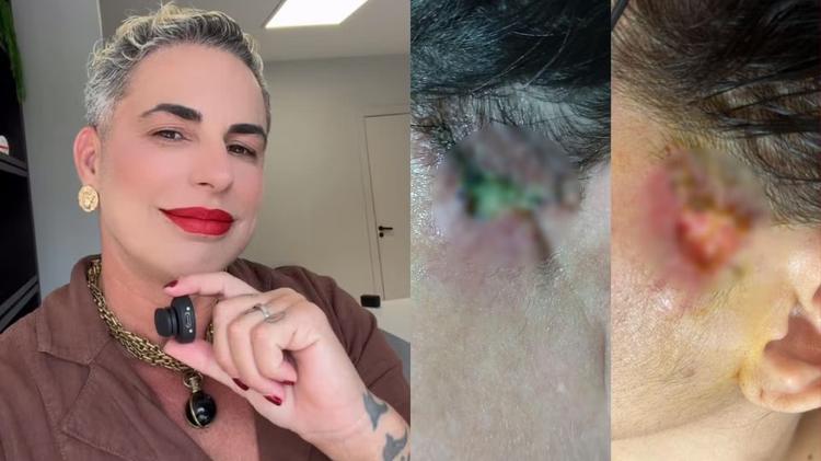 Ministério Público pede indenização de R$ 500 mil para pacientes deformadas por dentista influencer no ES; veja relato das vítimas