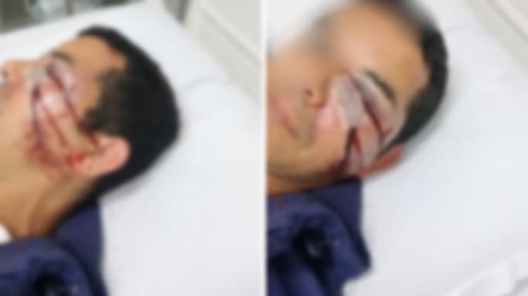 'Pela voz, vi que é gayzinho': vendedor é espancado por 6 rapazes e denuncia homofobia em Florianópolis