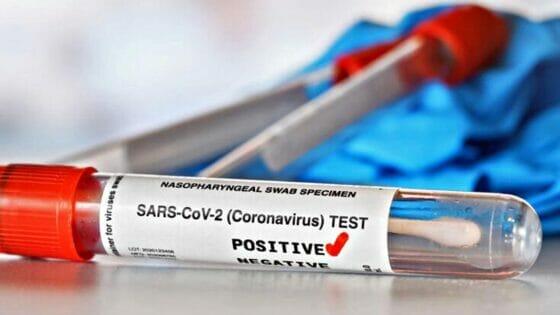 Coronavirus in Toscana, 129 nuovi casi, 12 decessi