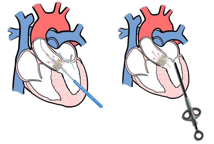 Torino ospedale molinette salvato