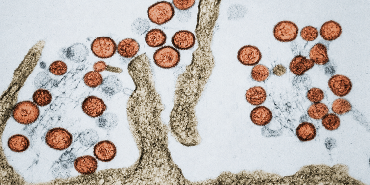 Cos'è l'hantavirus, ecco come si trasmette e quali sono i sintomi da non ignorare