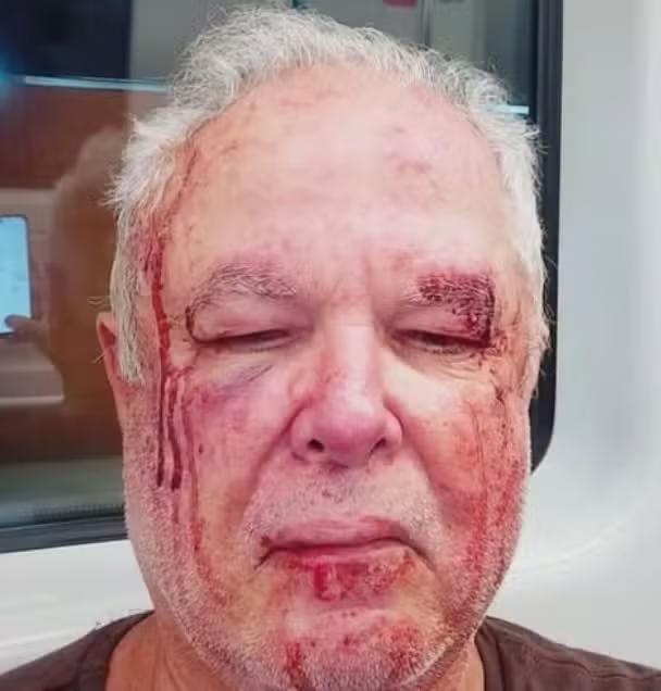 Polícia investiga agressão a idoso em Copacabana; homem diz que foi alvo de ofensas políticas e religiosas durante ataque