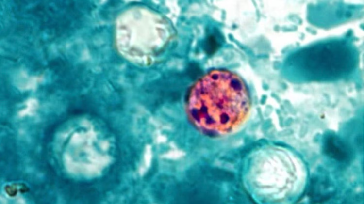 Taylor Farms expands lettuce recall to Mississippi amid cyclospora outbreak