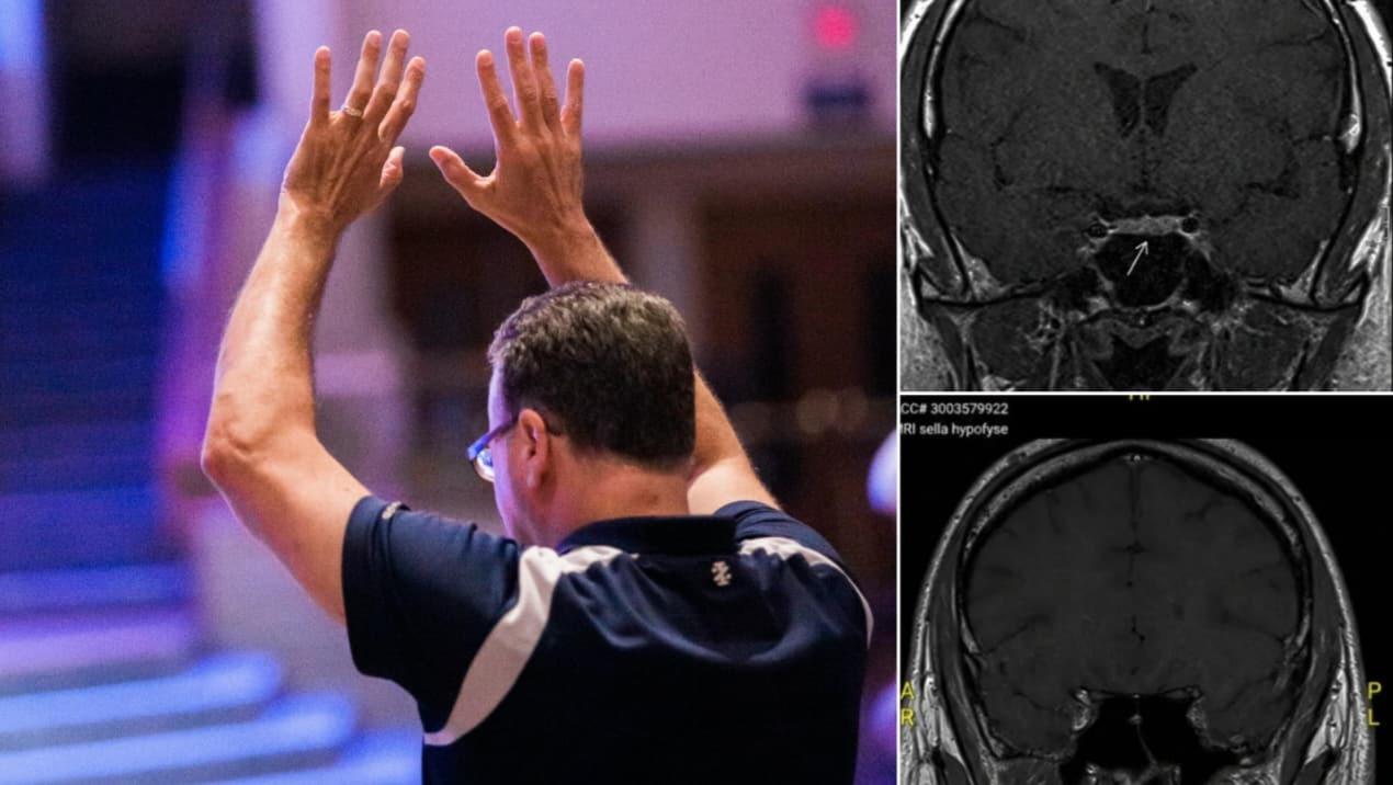 Tumor cerebral em homem desaparece após orações: “Os médicos não entenderam”