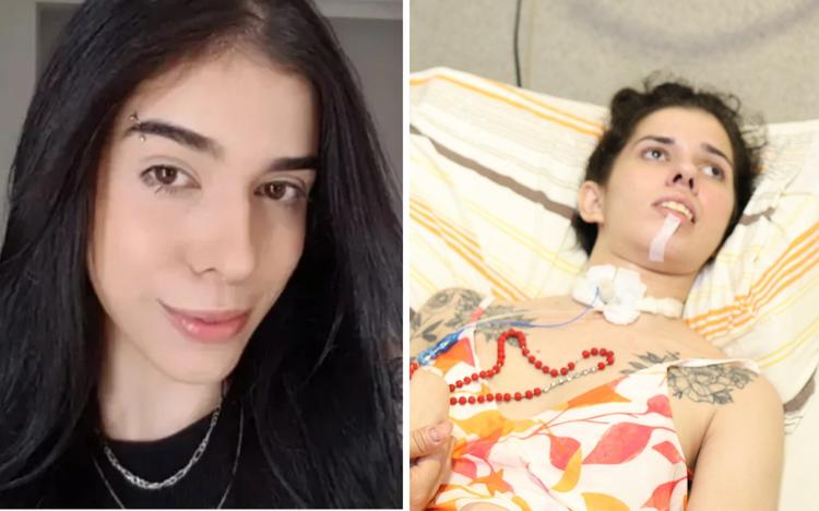 Jovem que teve reação alérgica grave após cheirar pimenta é internada novamente e está na UTI, diz família