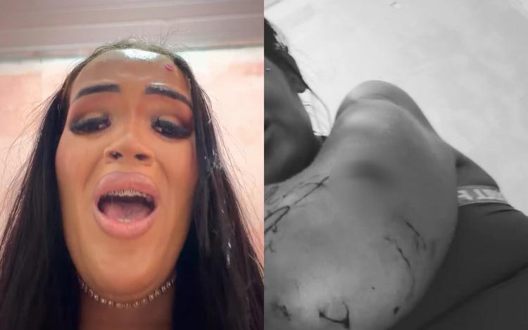 Influenciadora denuncia ter sido esfaqueada pela própria mãe dentro de casa: 'Me furou na frente de dois adolescentes'
