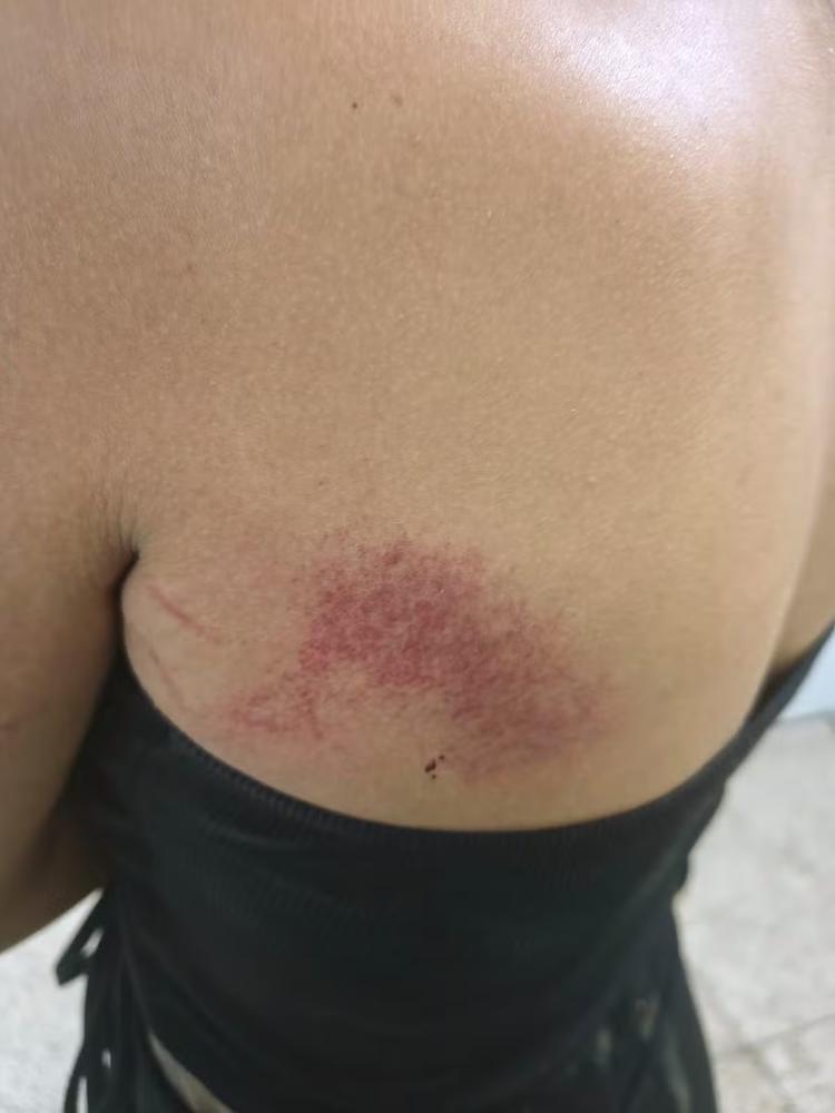 Homem é preso por violência doméstica após companheira fugir de agressão e pedir socorro em UPA de Piracicaba, diz Guarda