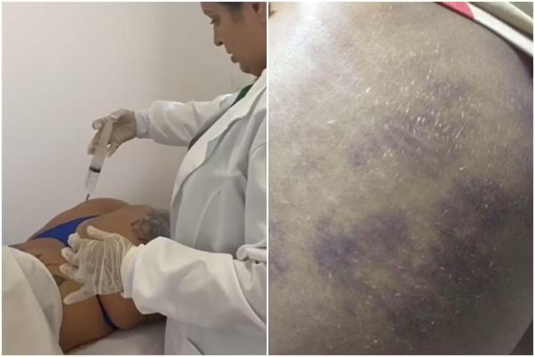 Falsa médica presa em João Pessoa pode responder por pelo menos quatro crimes, afirma delegado