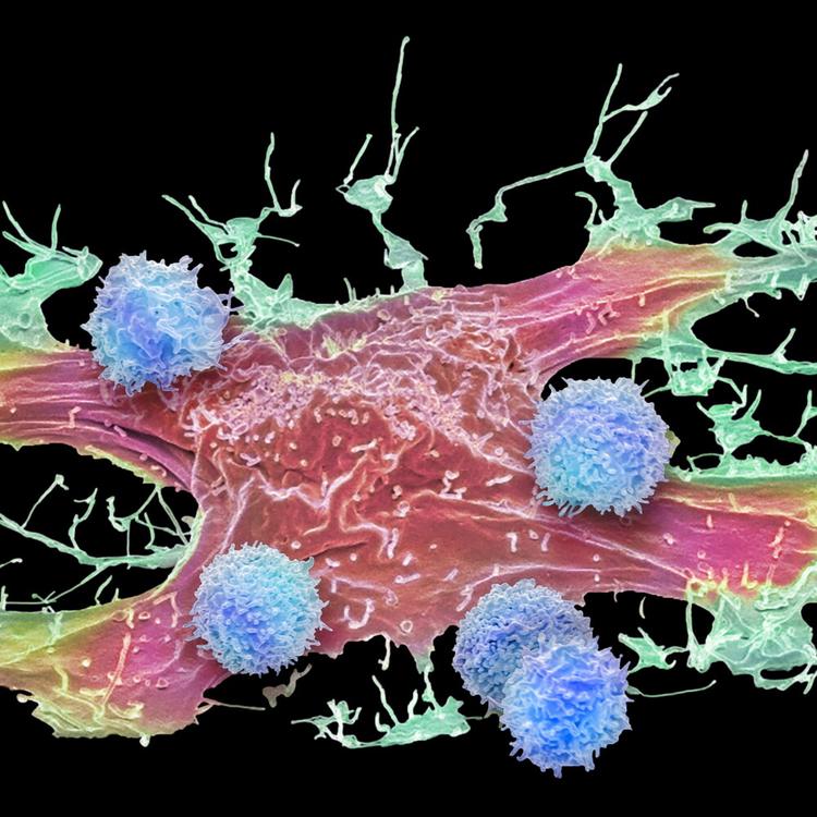 Le cellule piccole e alterate peggiorano il cancro
