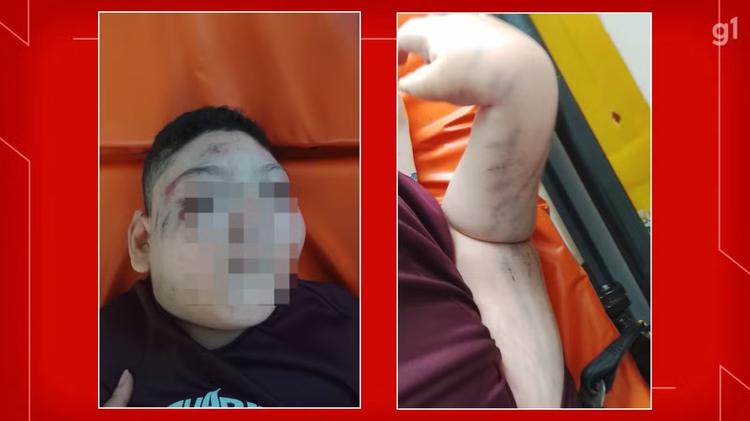 Cadeirante de 9 anos vai para a UTI após cair de escada rolante em estação do Metrô do DF