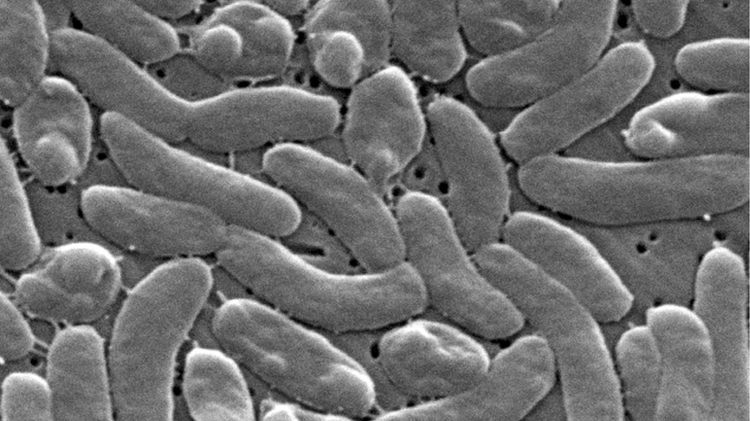 Health officials urging caution among Mississippi beachgoers amid ‘flesh-eating’ bacteria outbreak