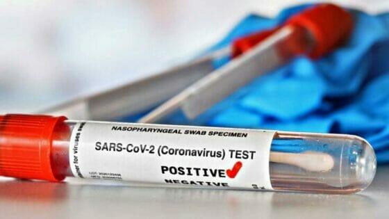 Coronavirus in Toscana, 437 nuovi casi, 5 decessi