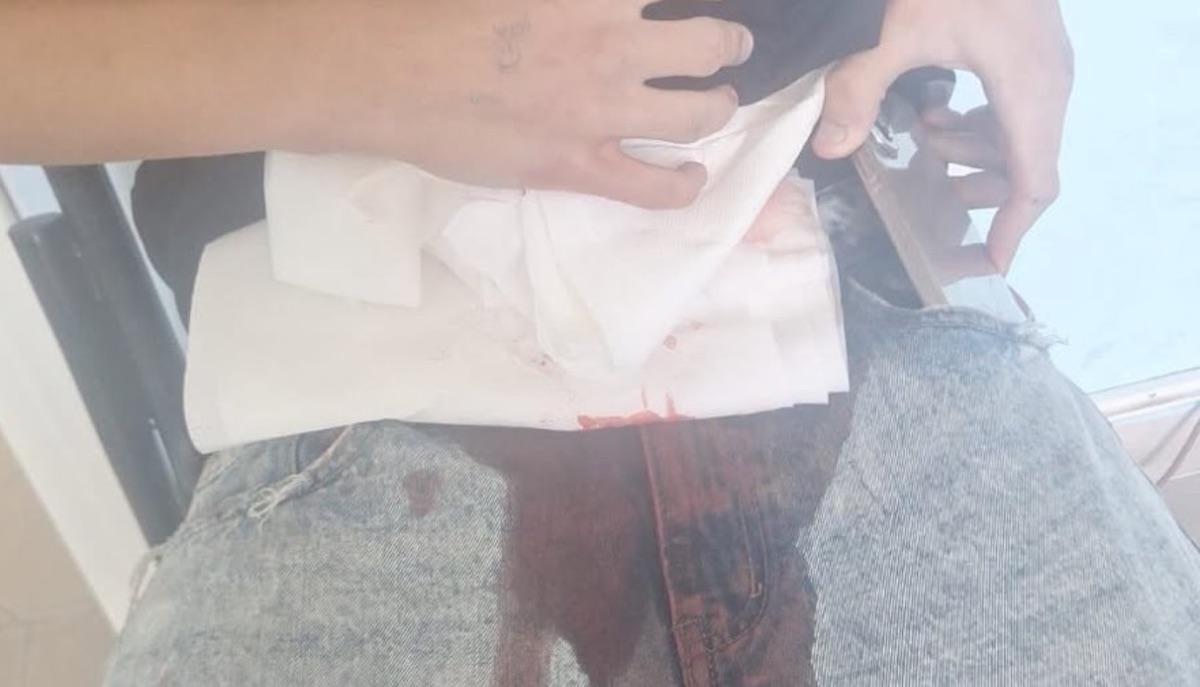 Castel Volturno, studente accoltellato a scuola: arrestato 14enne