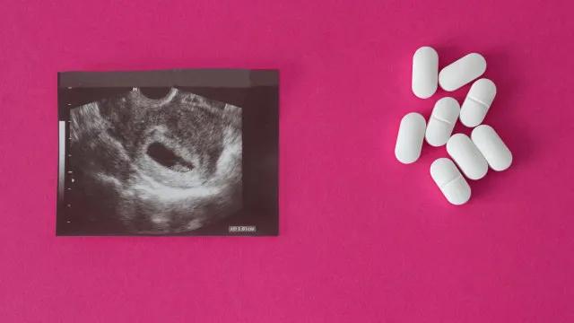 Metade das crianças grávidas com menos de 14 anos não recebe opção de aborto legal, diz pesquisa