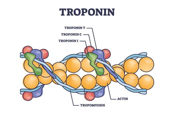 troponina