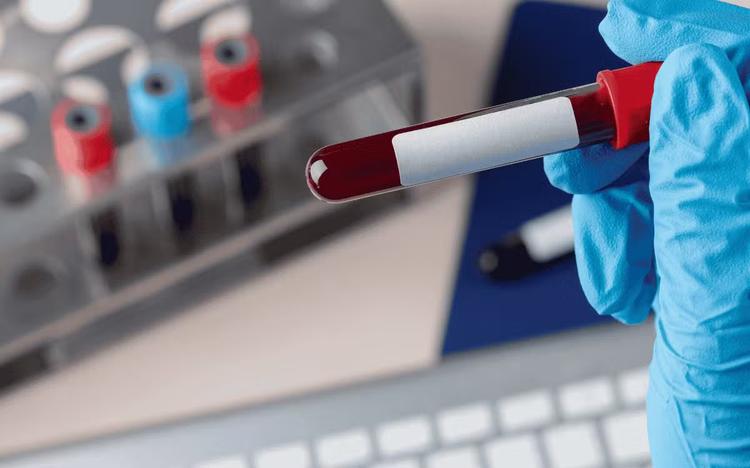 Rondônia tem 2ª maior taxa de hepatite B do Brasil e Porto Velho lidera entre capitais