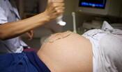 L'ormone dello stress in gravidanza influisce sul QI dei bimbi