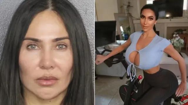 Brasileira é condenada por morte de sósia de Kim Kardashian após procedimento estético