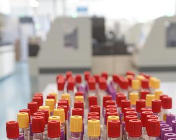 Malaria in aeroporto in Germania, gli esperti: "Campanello d'allarme, ma il rischio resta contenuto"