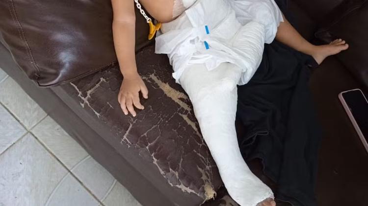Família denuncia mãe por lesão corporal após criança de 1 ano sofrer fratura na perna em Manaus; VÍDEO