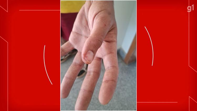 Estudante da UnB relata agressão em supermercado da Asa Norte, no DF