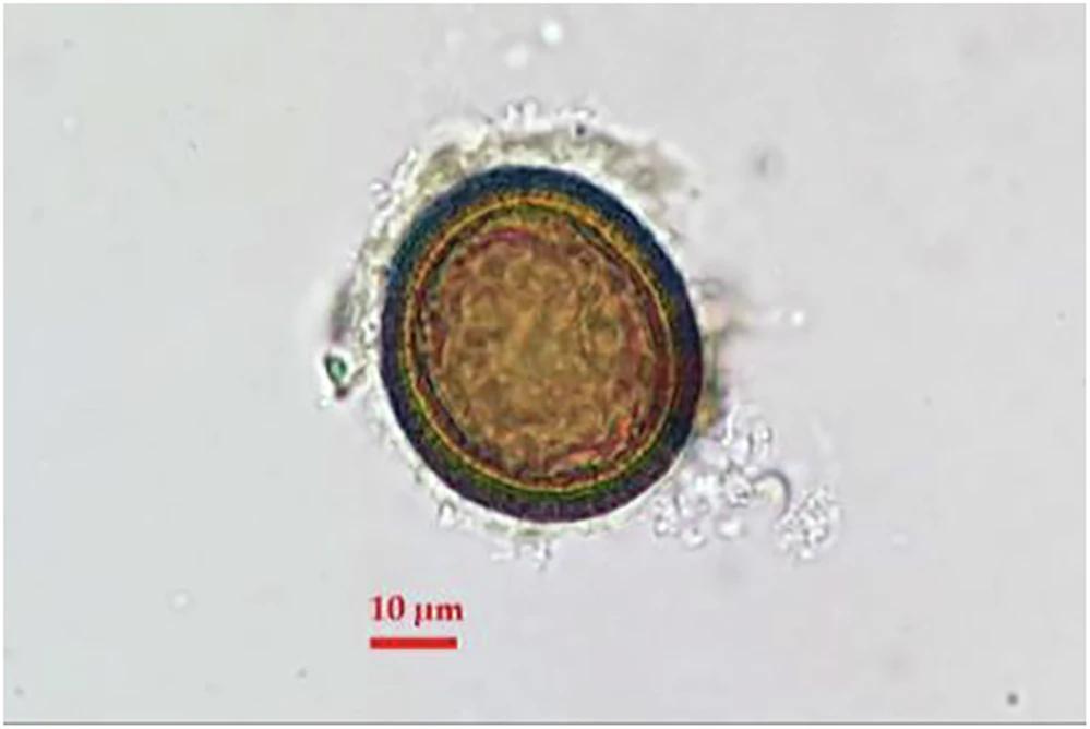 Roman Chamber Pots Reveal Surprising Parasite Linked to Americas