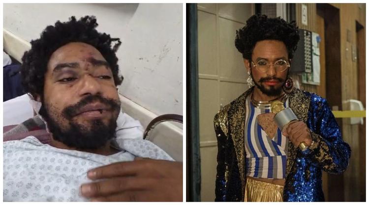 Ator montado de drag queen é espancado em adega no Centro de SP após ataque homofóbico