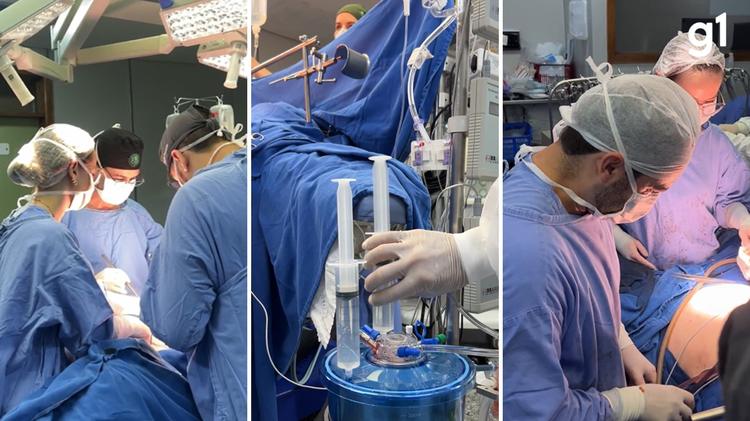 'Única chance': Paciente com câncer raro é a 1ª a passar por 'quimioterapia aquecida' no interior do RS; método pode ser mais eficaz que o tradicional