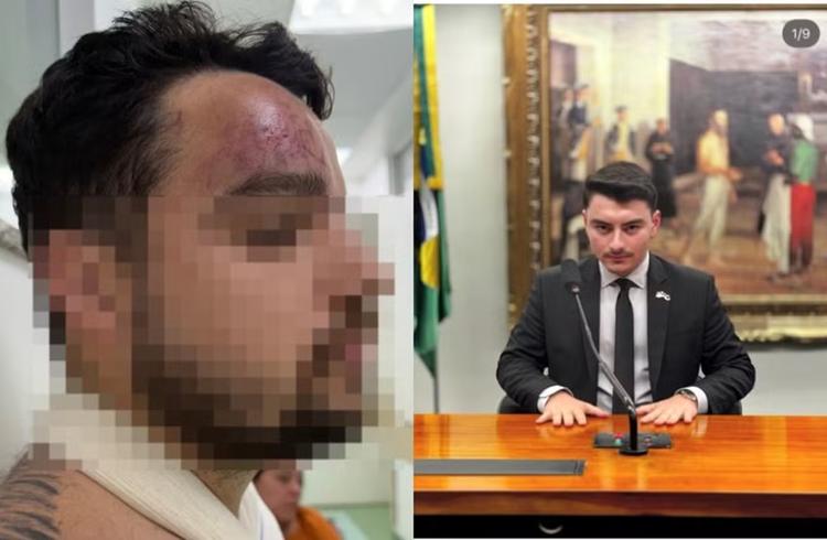 Esposa de homem agredido por assessor de Jair Renan Bolsonaro em SC diz que garrafa quase atingiu filho de 1 ano