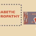 What Type Is It? Diabetic Neuropathy