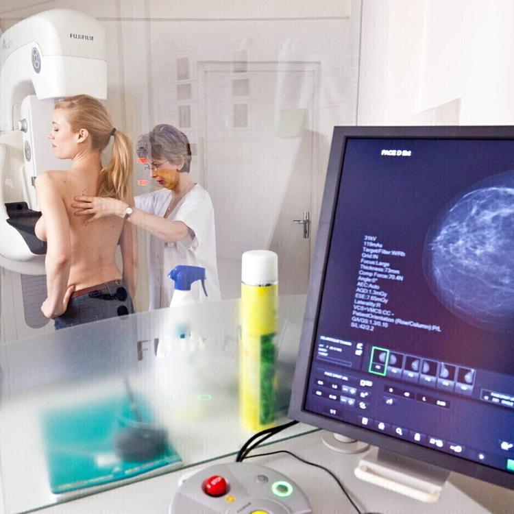 Un test genomico potrebbe risparmiare la chemio per il cancro al seno