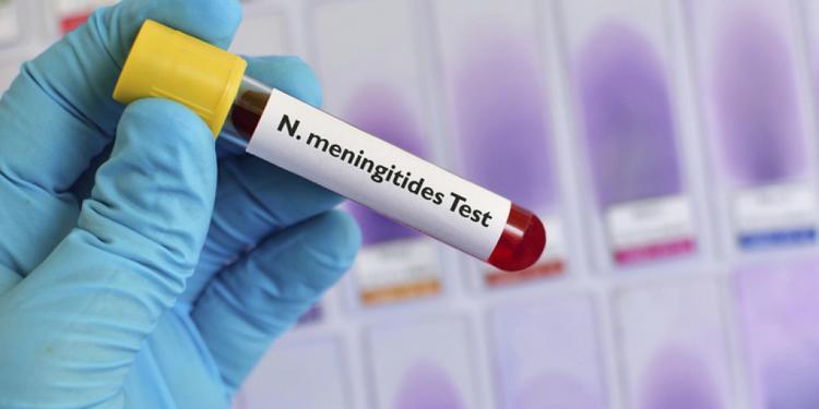 Controlli su 80 persone dopo un caso di meningite nell'Ennese