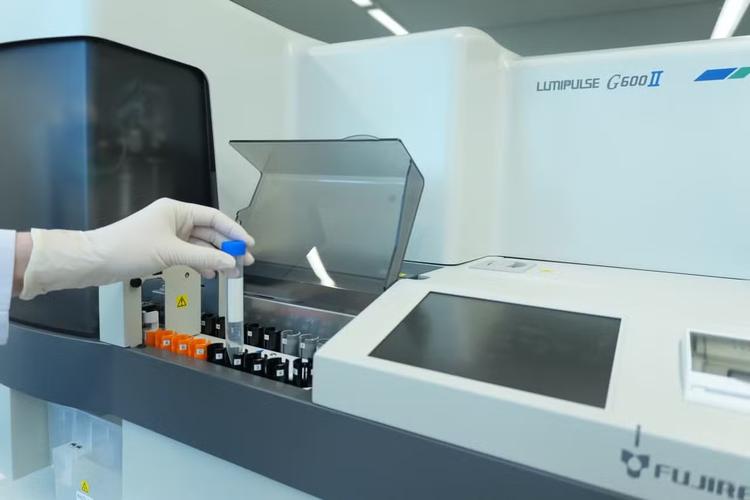 Exame de sangue para Alzheimer chega ao Brasil: veja quem pode fazer, quanto custa e o que o resultado revela