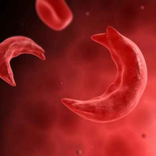 To have or not to have Children as a sickle cell carrier?