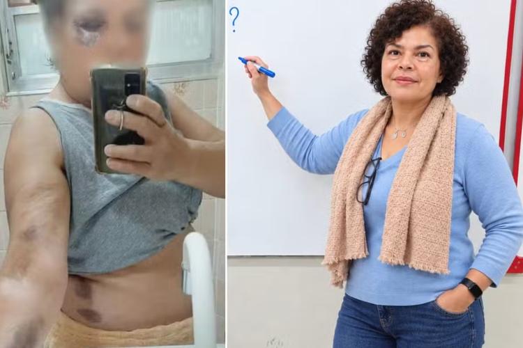 Professora agredida por aluno em escola de SP chama de ‘irrisória’ indenização de R$ 5 mil