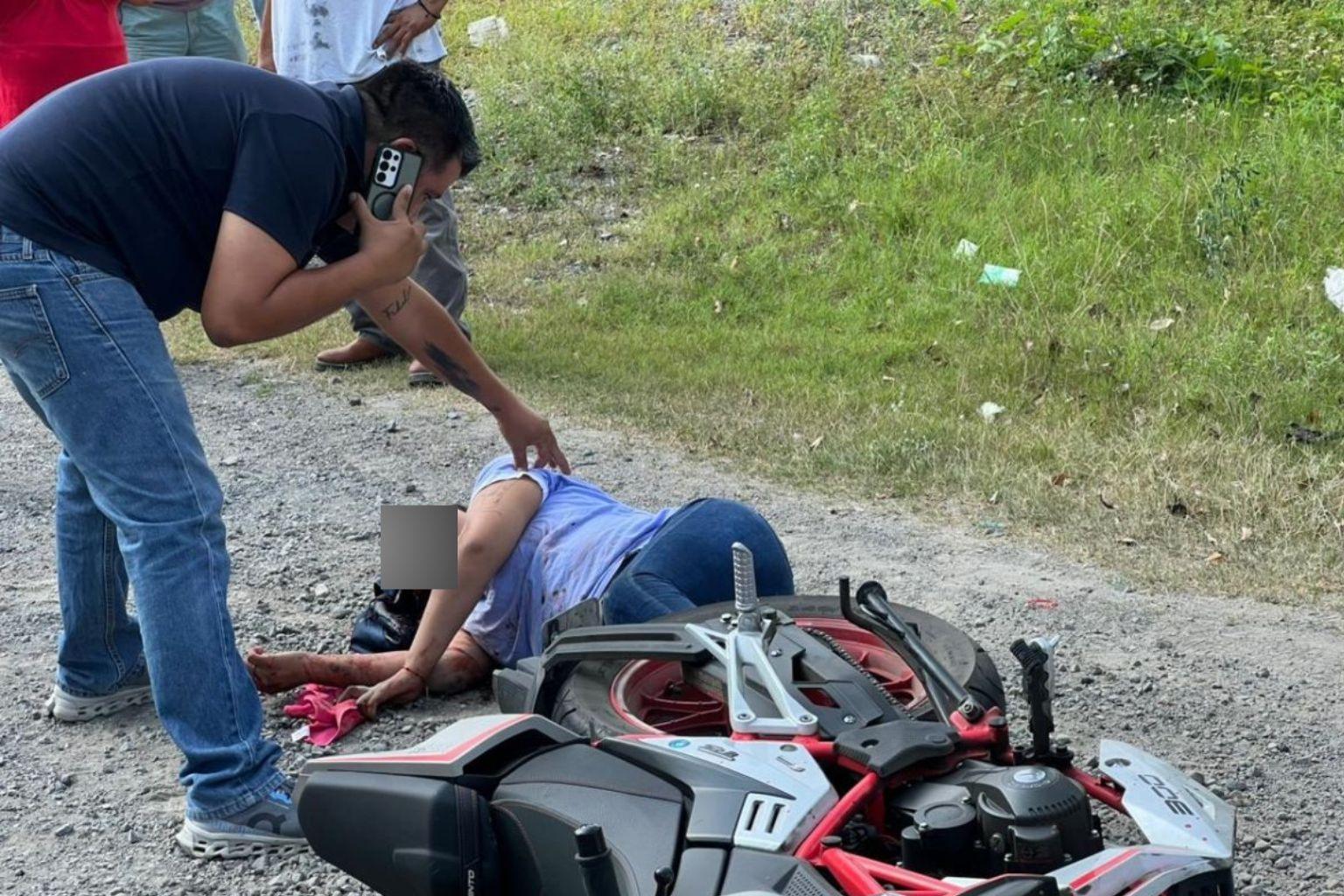 Katia Francelline, desfigurada del rostro en brutal accidente de motocicleta en Veracruz