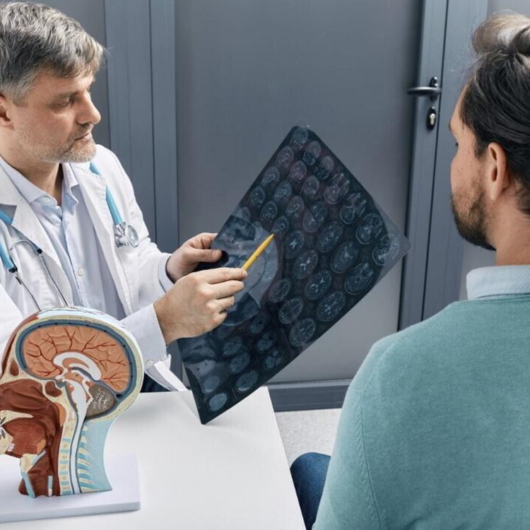 Dopo un ictus la stimolazione elettrica migliora la funzionalità del braccio