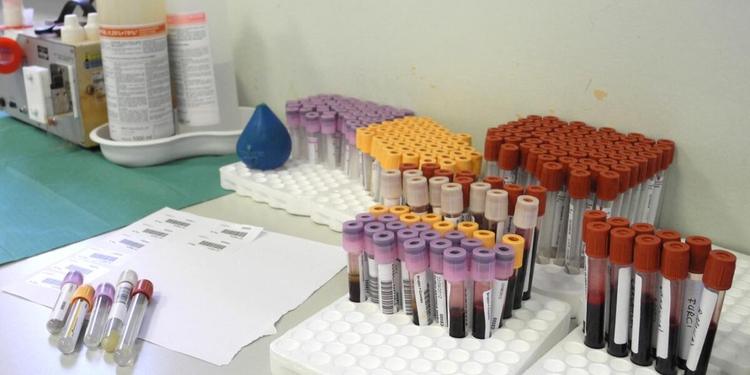 Emergenza sangue in Calabria: «Intensificare le donazioni»