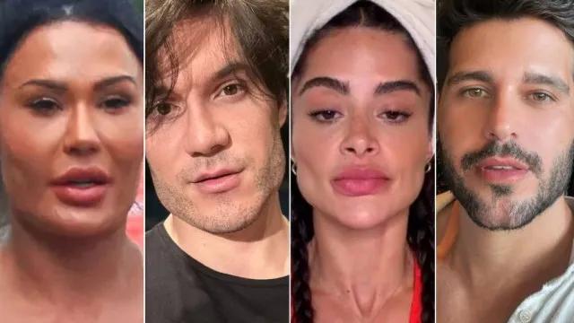 Famosos voltam atrás e revertem procedimentos estéticos em busca de naturalidade